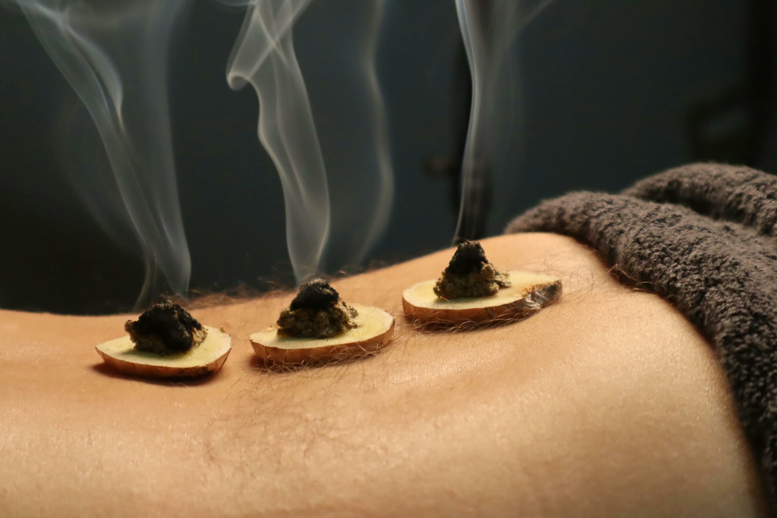 Pratique de la moxibustion